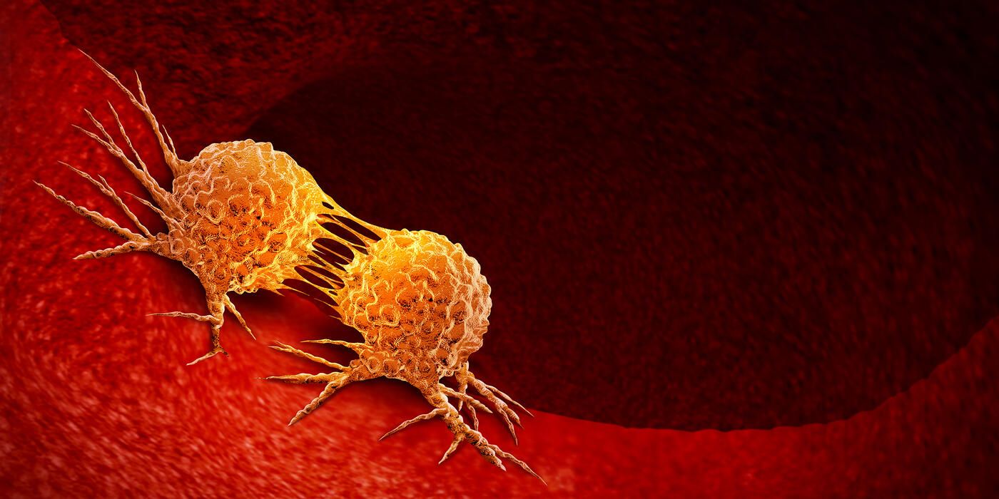 A cancer cell divides