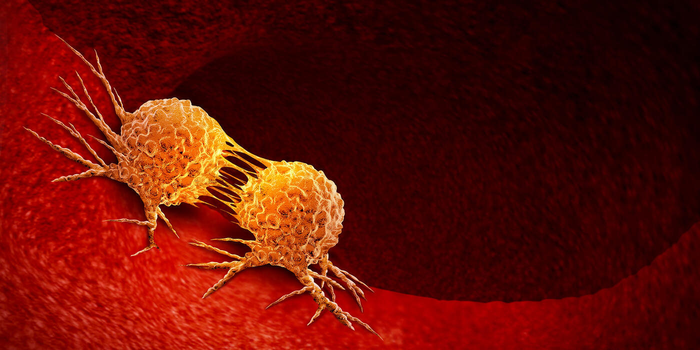 A cancer cell divides