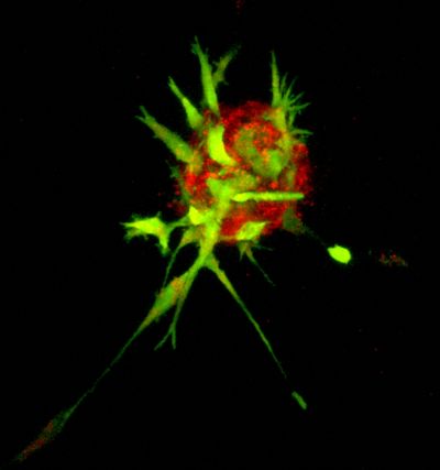 The Wistar Institute Melanoma Research Center